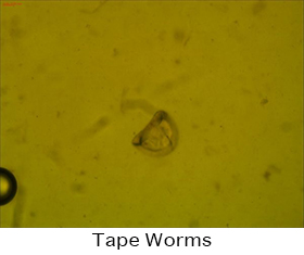 Tape Worms