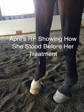 April's RF Showing How She Stood Before Her Treatment